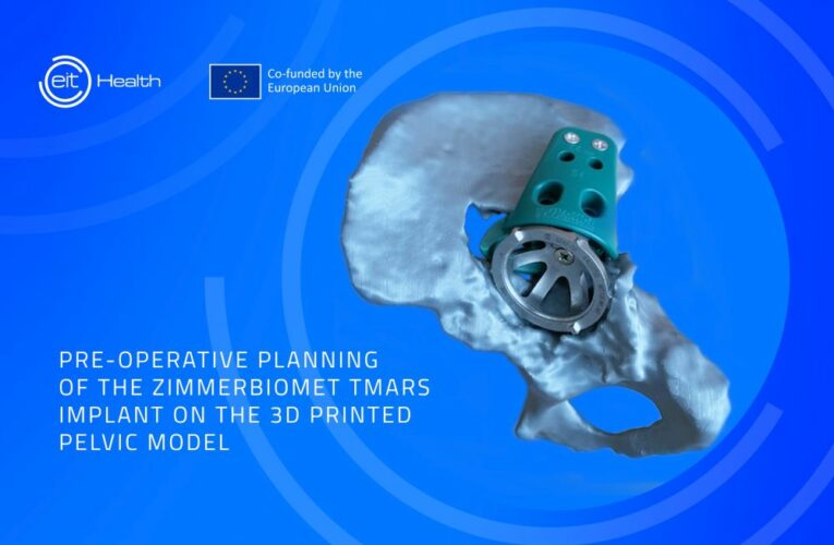 3D tisk v nemocnicích – česká zdravotnická inovace získává evropskou podporu
