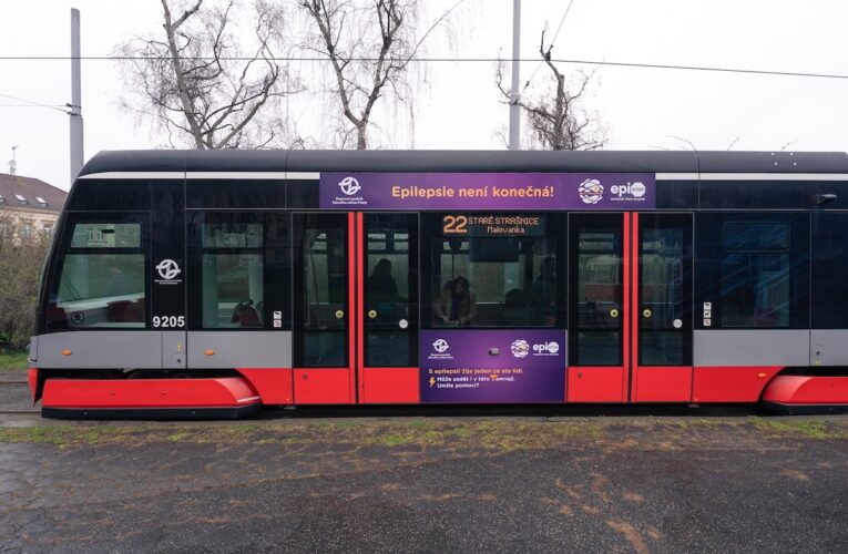 Řada lidí se bojí záchvatu epilepsie